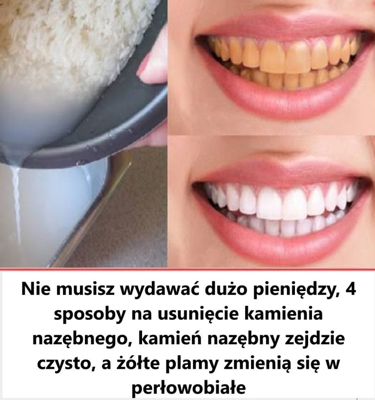 Jak dbać o zęby i oszczędzać na wizytach u dentysty – domowe sposoby na zdrowy uśmiech