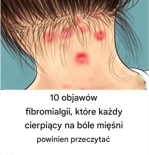 „10 cichych sygnałów fibromialgii – nie ignoruj, jeśli doskwiera Ci ból mięśni”