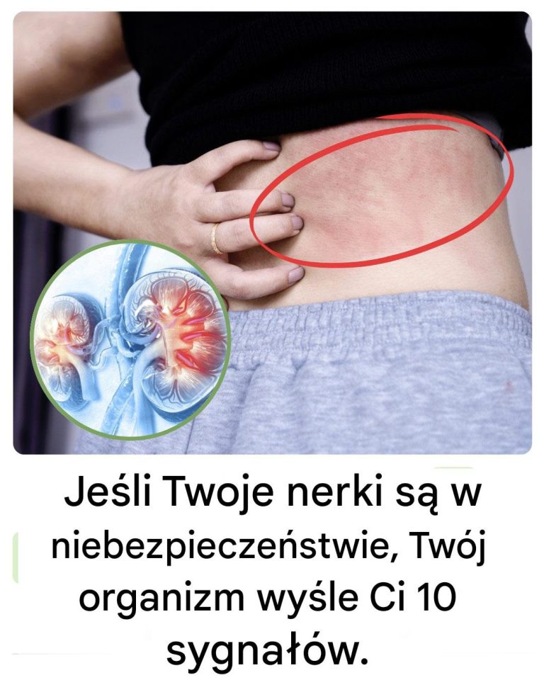 10 subtelnych sygnałów, które mogą świadczyć o problemach z nerkami – naucz się je rozpoznawać zanim będzie za późno