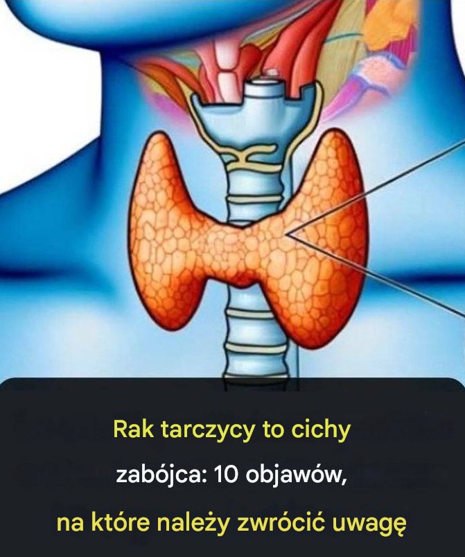 Rak tarczycy to cichy zabójca: 10 objawów, na które należy zwrócić uwagę