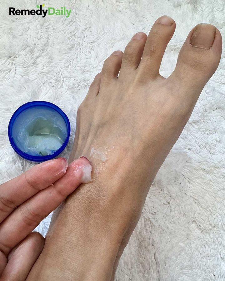Kobieta wciera sobie w stopy maść Vicks Vaporub przed snem z tego genialnego powodu