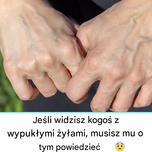 Dlaczego moje żyły nagle stały się widoczne i nabrzmiałe?