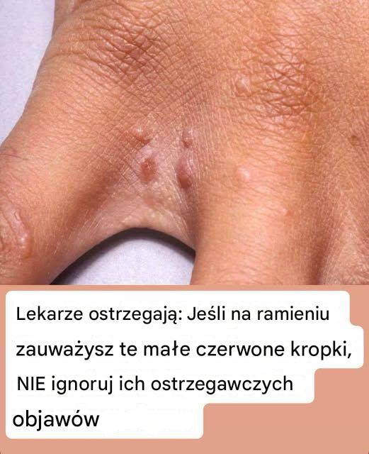 Nie ignoruj tych małych czerwonych plamek na ramieniu – mogą być ważnymi znakami ostrzegawczymi